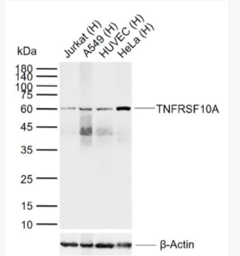 TNFRSF10A 死亡受体4抗体,TNFRSF10A