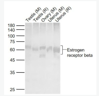 Estrogen receptor beta 雌激素受体β 抗体,Estrogen receptor beta