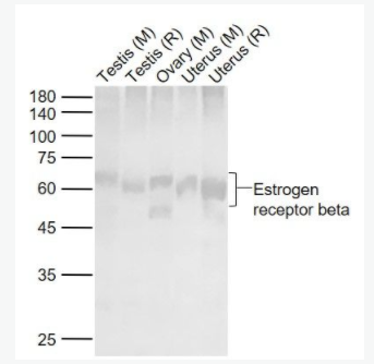 Estrogen receptor beta 雌激素受體β 抗體,Estrogen receptor beta