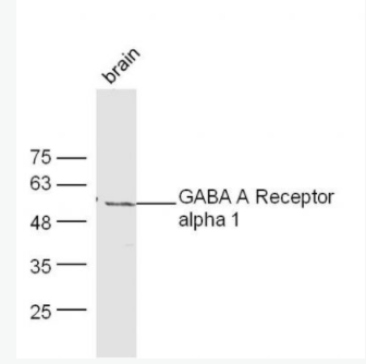 GABRA1/GABA A Receptor alpha 1 G1氨基丁酸A型受體α1抗體,GABRA1/GABA A Receptor alpha 1