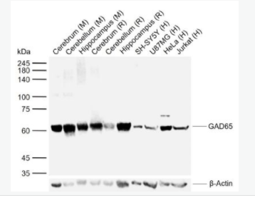 GAD65 谷氨酸脱羧酶-65抗体(C端）,GAD65