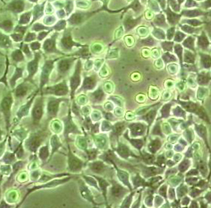 RT-112人膀胱癌细胞,RT-112 human bladder cancer cells