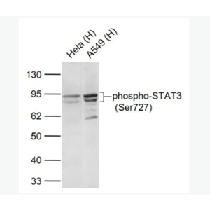 phospho-STAT3 (Ser727) 磷酸化信號(hào)轉(zhuǎn)導(dǎo)和轉(zhuǎn)錄激活因子3重組兔單克隆抗體