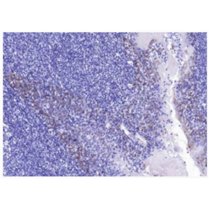 Cytokeratin 14 细胞角蛋白14t重组兔单克隆抗体