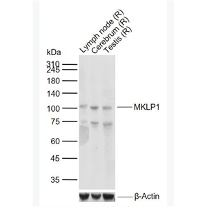MKLP1 有丝分裂驱动蛋白样1重组兔单克隆抗体,MKLP1