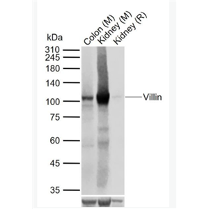 villin 绒毛蛋白重组兔单克隆抗体,villin