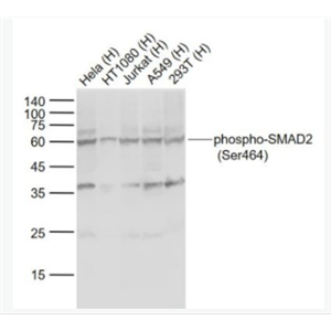 phospho-SMAD2 (Ser464) 磷酸化细胞信号转导分子SMAD2抗体,phospho-SMAD2 (Ser464)