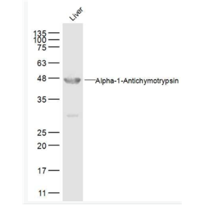 AACT α-1抗胰糜蛋白酶/SERPINA3抗体,AACT