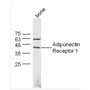 Adiponectin Receptor 1 脂联素受体1抗体,Adiponectin Receptor 1