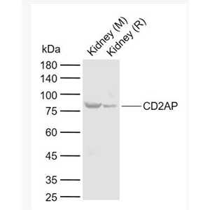 CD2AP 白细胞分化抗原CD2AP抗体