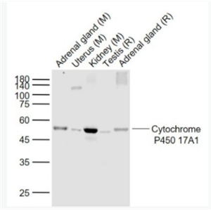  Cytochrome P450 17A1细胞色素P450 17A1重组兔单克隆抗体