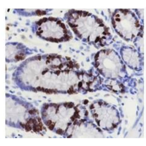 Ki67 Ki67蛋白重組兔單克隆抗體
