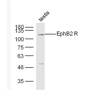 EphB2 酪氨酸蛋白激酶受体B2抗体