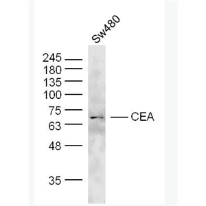 CEA 癌胚抗原抗体