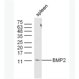 BMP2 骨形态发生蛋白2抗体