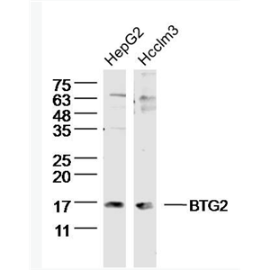 BTG2 B细胞迁移基因2抗体,BTG2