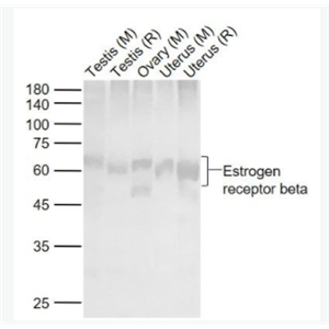 Estrogen receptor beta 雌激素受体β 抗体,Estrogen receptor beta