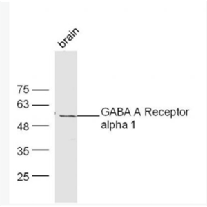 GABRA1/GABA A Receptor alpha 1 G1氨基丁酸A型受体α1抗体,GABRA1/GABA A Receptor alpha 1