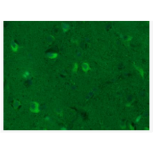 GAP43 神经生长相关蛋白43抗体