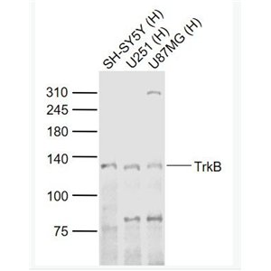 TrkB 酪氨酸激酶B抗体
