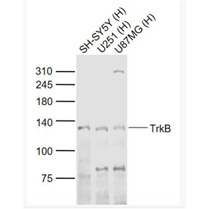 TrkB 酪氨酸激酶B抗體,TrkB