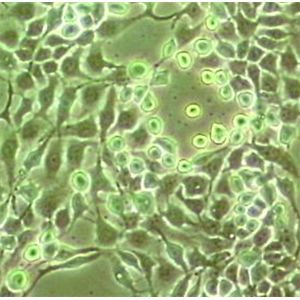 RT-112人膀胱癌细胞