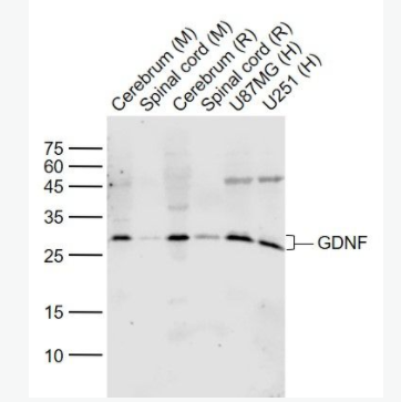 GDNF 胶质细胞源性神经营养因子抗体,GDNF
