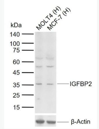 IGFBP2 胰岛素样生长因子结合蛋白2抗体,IGFBP2