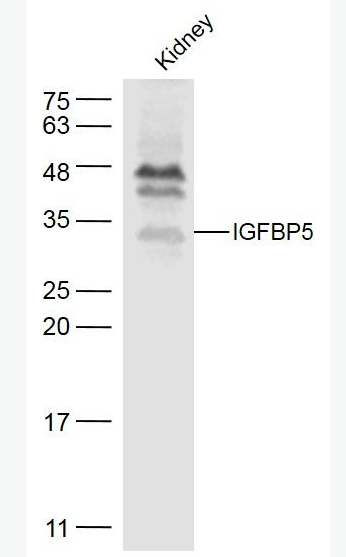 IGFBP5 胰岛素样生长因子结合蛋白5抗体,IGFBP5