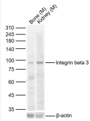 ITGB3 整合素β3/CD61抗体,ITGB3