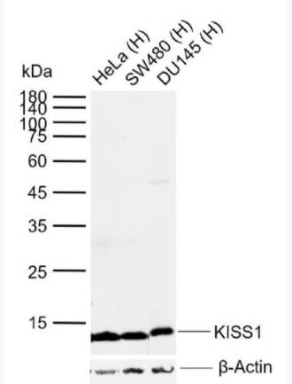 KISS1 肿瘤转移抑制基因抗体,KISS1