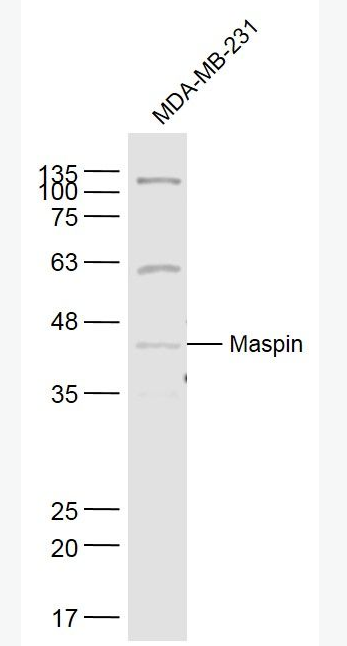 Maspin 抑癌基因抗体,Maspin