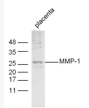 MMP1基质金属蛋白酶-1抗体,MMP1
