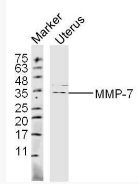 MMP7 基质金属蛋白酶-7抗体,MMP7