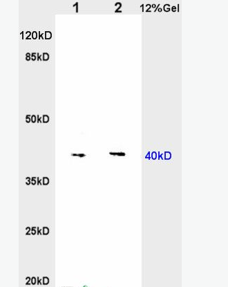 Nociceptin receptor 孤菲肽受体/痛敏肽受体抗体,Nociceptin receptor