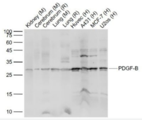 PDGF-B 血小板源性生长因子-B抗体,PDGF-B