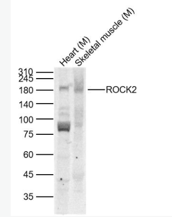 ROCK2 Rho相关蛋白激酶2抗体,ROCK2