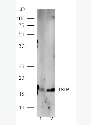 TSLP 胸腺基质淋巴细胞生成素-1抗体,TSLP