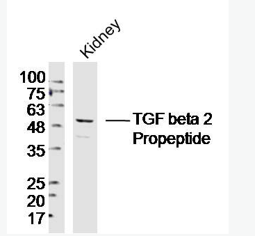 TGF beta 2 Propeptide 轉(zhuǎn)移生長因子β2抗體,TGF beta 2 Propeptide