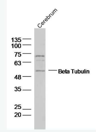 Beta Tubulin 微管蛋白抗体,Beta Tubulin