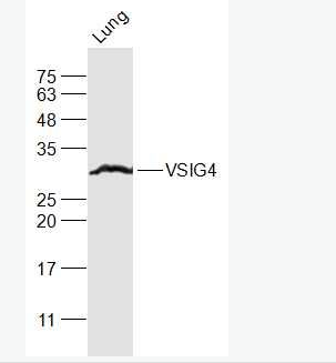 VSIG4 T淋巴細胞負調(diào)節(jié)蛋白抗體,VSIG4