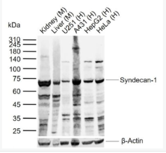 Syndecan-1 多配体蛋白聚糖1（CD138）抗体,Syndecan-1