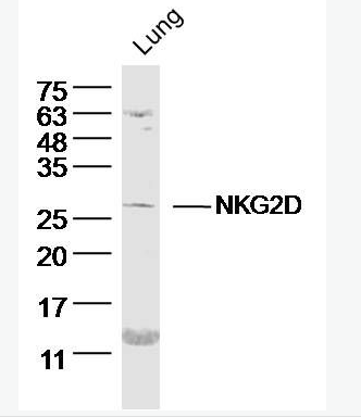 NKG2D NK细胞受体2D（CD314）抗体,NKG2D