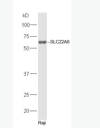 OAT1 / SLC22A6 阴离子转运蛋白-1抗体,OAT1 / SLC22A6