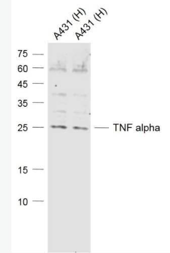 TNF alpha 肿瘤坏死因子-α抗体,TNF alpha