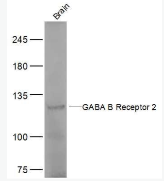 GABBR2 G氨基丁酸B型受体2抗体,GABBR2