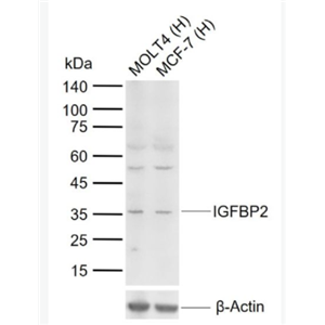 IGFBP2 胰岛素样生长因子结合蛋白2抗体,IGFBP2