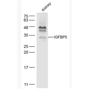 IGFBP5 胰岛素样生长因子结合蛋白5抗体