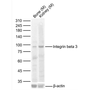 ITGB3 整合素β3/CD61抗体