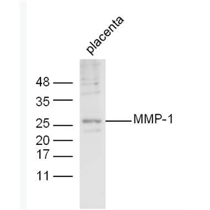 MMP1 基质金属蛋白酶-1抗体